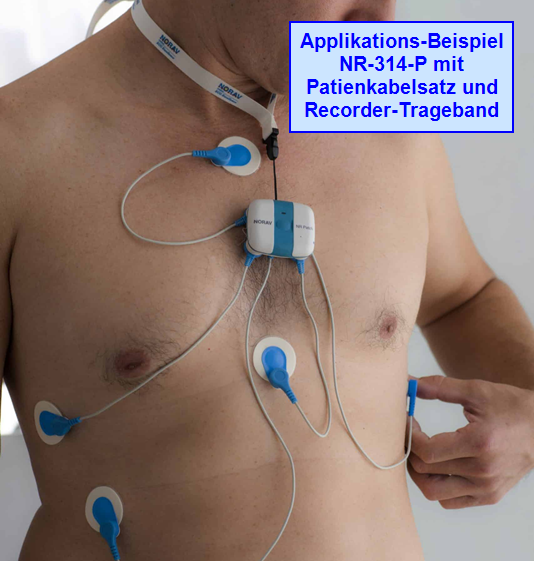 Langzeit-EKG-Kit M25 inkl. Datenbank - 14 Tage EKG-Überwachung