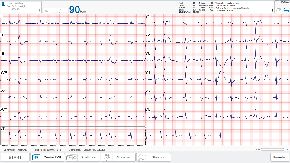 NR-1207-3 All-In-One - EKG-System