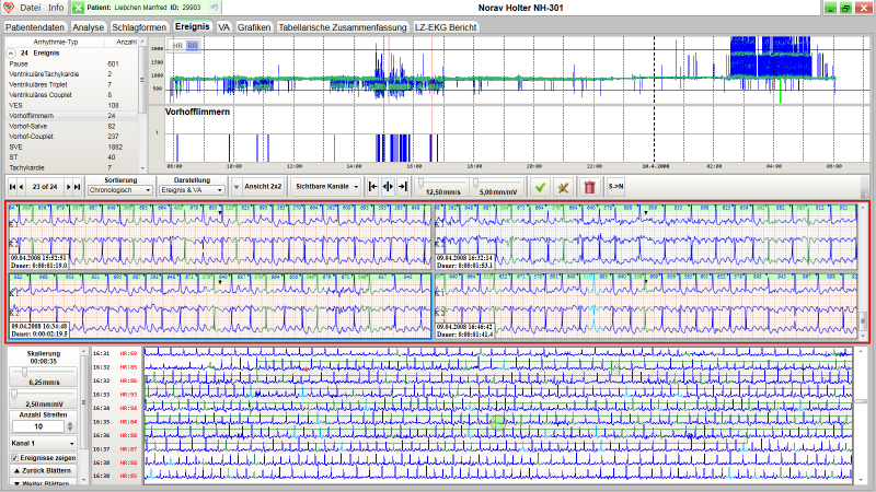 Langzeit-EKG-Kit4 - All-In-One