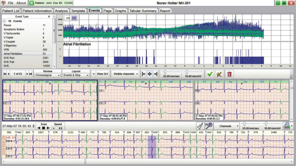 Langzeit-EKG-Kit4 - All-In-One