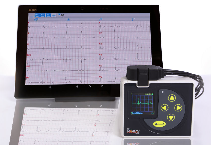 NR-1207-E als Ruhe- und Belastungs-EKG