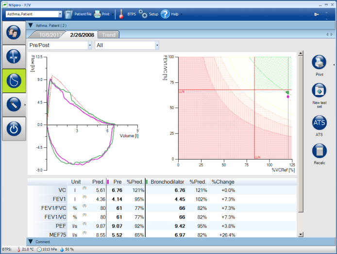 Digitaler Spirometrie-Messplatz SpiroStik Blueflow
