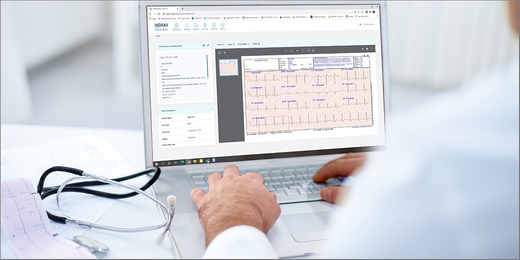 Langzeit-EKG-Kit M25 inkl. Datenbank - 14 Tage EKG-Überwachung