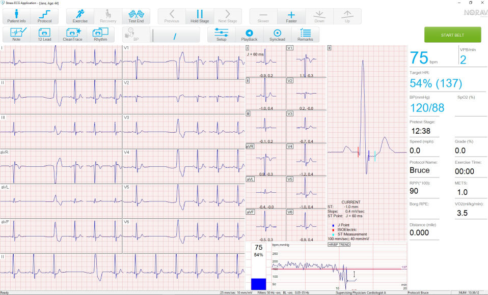 PC-EKG 1200S - Klassisches Digital-EKG