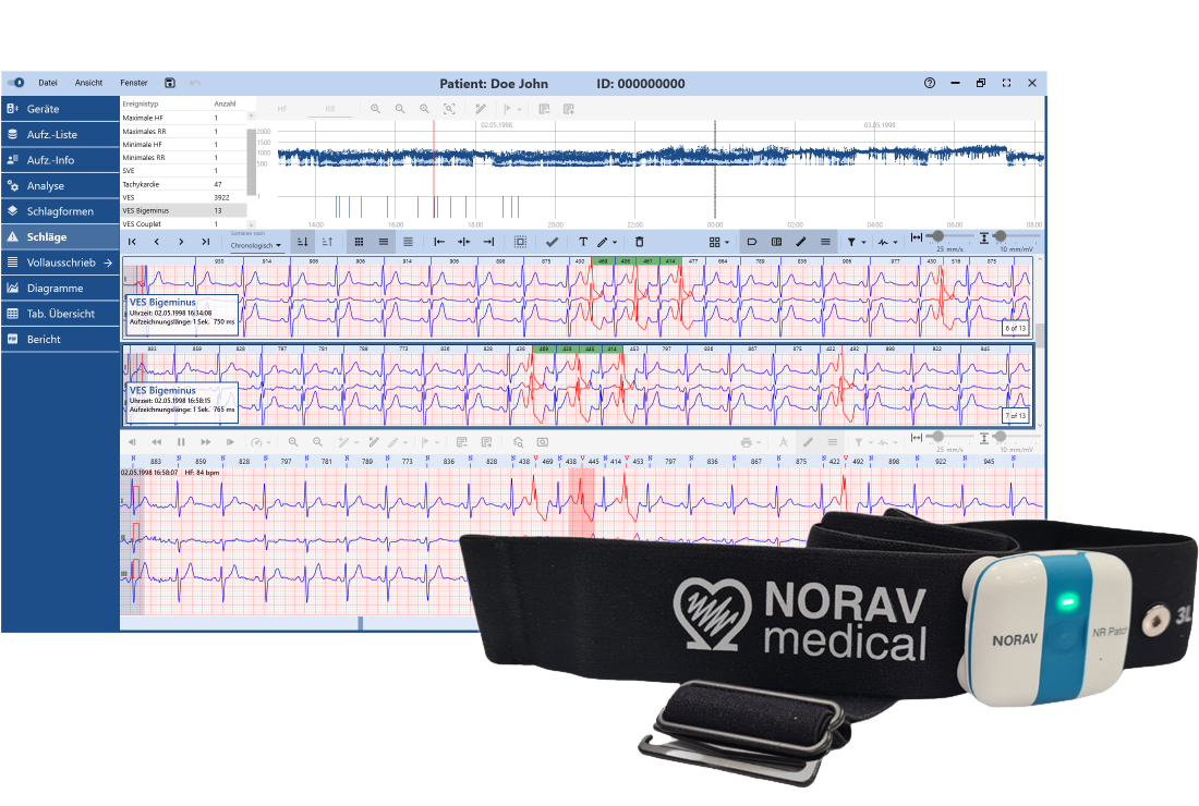 Langzeit-EKG-Kit M25 inkl. Datenbank - 14 Tage EKG-Überwachung