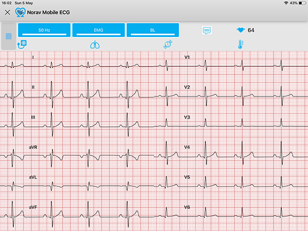 NR-1207-3 Multifunktions-EKG-System mit Interpretation