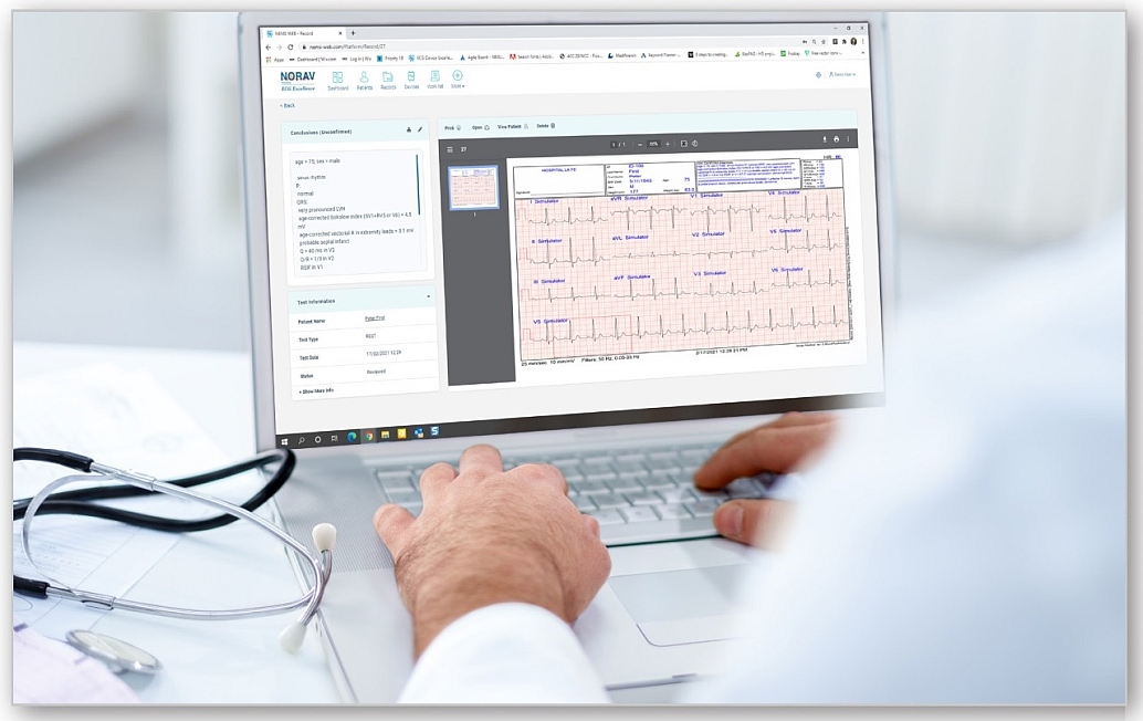 NEMS-Q-10 - Norav EKG Management System