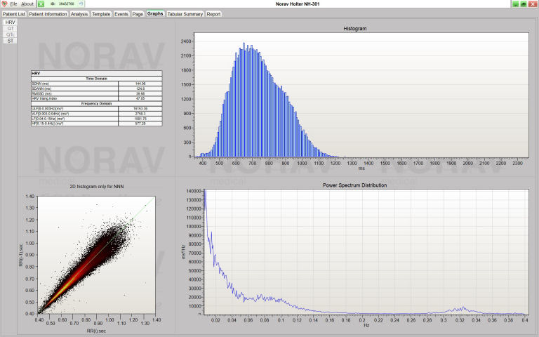 Langzeit-EKG-Kit4 - All-In-One