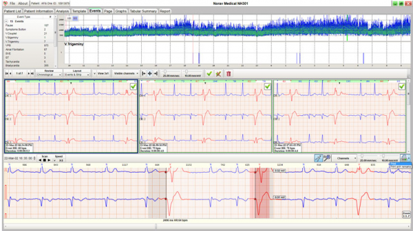 NH-301 High-End Analyse Software für Langzeit-EKG